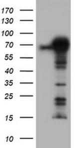 TRIM9 Antibody in Western Blot (WB)