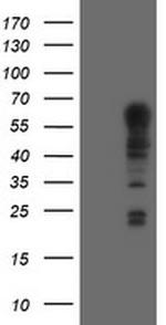 TRIM9 Antibody in Western Blot (WB)