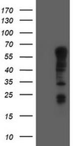 TRIM9 Antibody in Western Blot (WB)