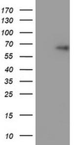 TRIM9 Antibody in Western Blot (WB)