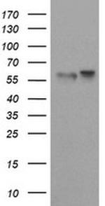 TRIM9 Antibody in Western Blot (WB)