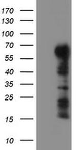 TRIM9 Antibody in Western Blot (WB)