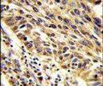 TRIP13 Antibody in Immunohistochemistry (IHC)