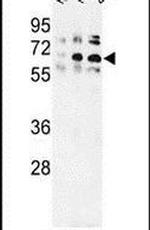 TRIP13 Antibody in Western Blot (WB)