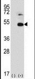 TRIP13 Antibody in Western Blot (WB)