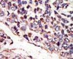 TrkC Antibody in Immunohistochemistry (IHC)
