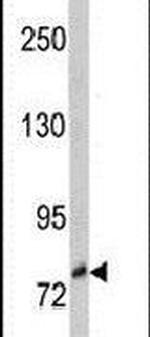 TrkC Antibody in Western Blot (WB)