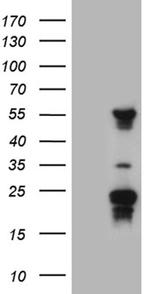 TRMT12 Antibody in Western Blot (WB)