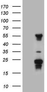 TRMT12 Antibody in Western Blot (WB)