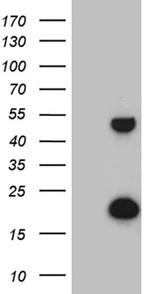 TRMT12 Antibody in Western Blot (WB)