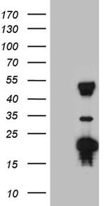 TRMT12 Antibody in Western Blot (WB)