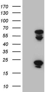 TRMT12 Antibody in Western Blot (WB)