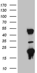 TRMT12 Antibody in Western Blot (WB)