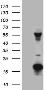 TRMT12 Antibody in Western Blot (WB)