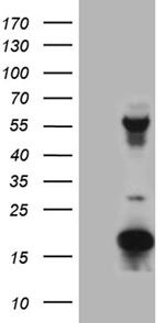 TRMT12 Antibody in Western Blot (WB)