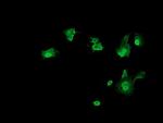 TRMT2A Antibody in Immunocytochemistry (ICC/IF)