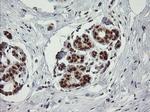 TRMT2A Antibody in Immunohistochemistry (Paraffin) (IHC (P))