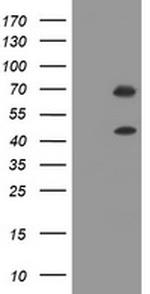 TRMT2A Antibody in Western Blot (WB)