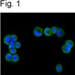 TRPM4 Antibody in Immunocytochemistry (ICC/IF)