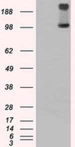 TRPM4 Antibody in Western Blot (WB)