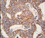 TRPM8 Antibody in Immunohistochemistry (IHC)