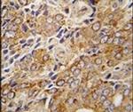 TRPM8 Antibody in Immunohistochemistry (IHC)
