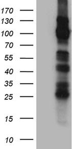 TRPM8 Antibody in Western Blot (WB)