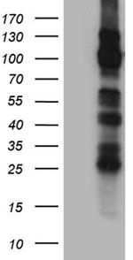 TRPM8 Antibody in Western Blot (WB)