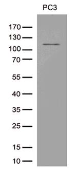 TRPM8 Antibody in Western Blot (WB)
