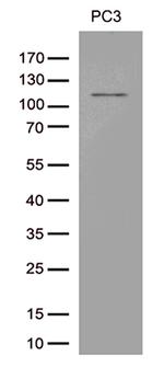 TRPM8 Antibody in Western Blot (WB)