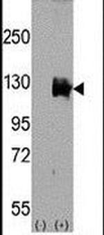 TRPM8 Antibody in Western Blot (WB)