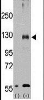 TRPM8 Antibody in Western Blot (WB)