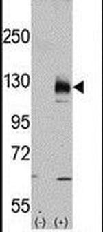 TRPM8 Antibody in Western Blot (WB)