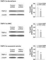 TRPV1 Antibody in Western Blot (WB)