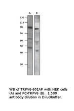 TRPV6 Polyclonal Antibody