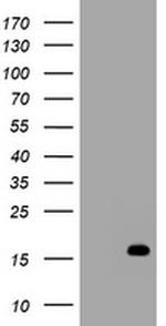 TSC22D1 Antibody in Western Blot (WB)