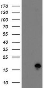 TSC22D1 Antibody in Western Blot (WB)