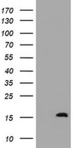 TSC22D1 Antibody in Western Blot (WB)