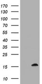 TSC22D1 Antibody in Western Blot (WB)
