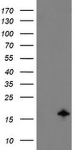 TSC22D1 Antibody in Western Blot (WB)