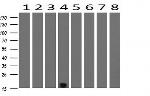 TSC22D1 Antibody in Western Blot (WB)