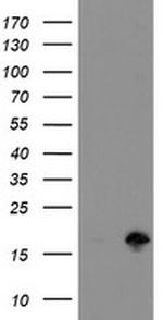 TSC22D1 Antibody in Western Blot (WB)