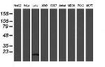 TSC22D1 Antibody in Western Blot (WB)
