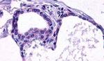 TSH Receptor Antibody in Immunohistochemistry (Paraffin) (IHC (P))