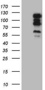 TSHZ1 Antibody in Western Blot (WB)