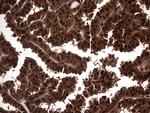 TSN Antibody in Immunohistochemistry (Paraffin) (IHC (P))