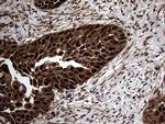 TSN Antibody in Immunohistochemistry (Paraffin) (IHC (P))