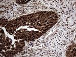 TSN Antibody in Immunohistochemistry (Paraffin) (IHC (P))