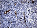 TSPAN7 Antibody in Immunohistochemistry (Paraffin) (IHC (P))