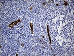 TSPAN7 Antibody in Immunohistochemistry (Paraffin) (IHC (P))